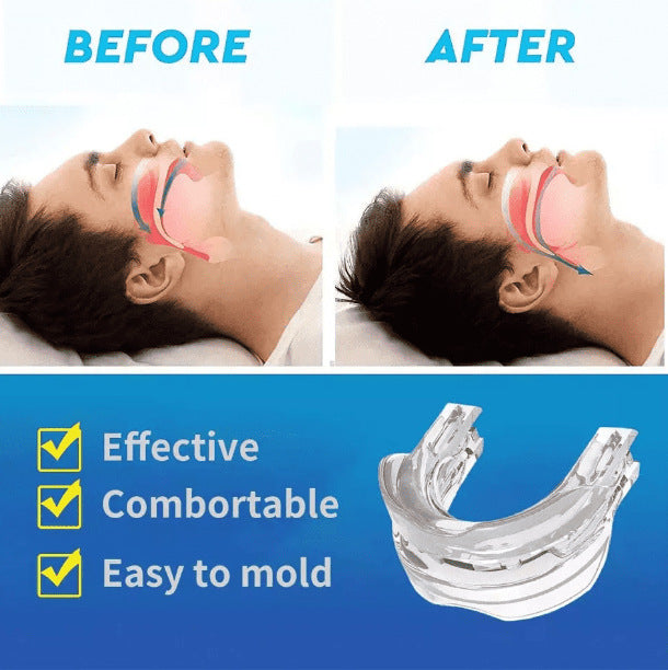 DreamGuard Anti-Snoring Mouthpiece